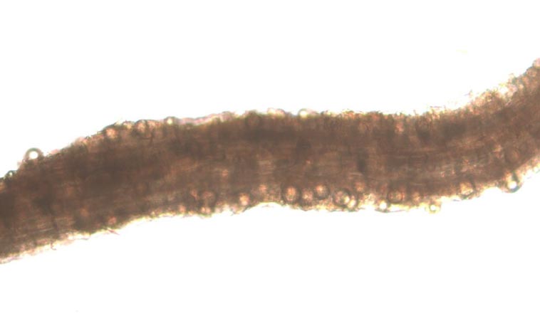 Pythium diseases are not all the same Pythium infection