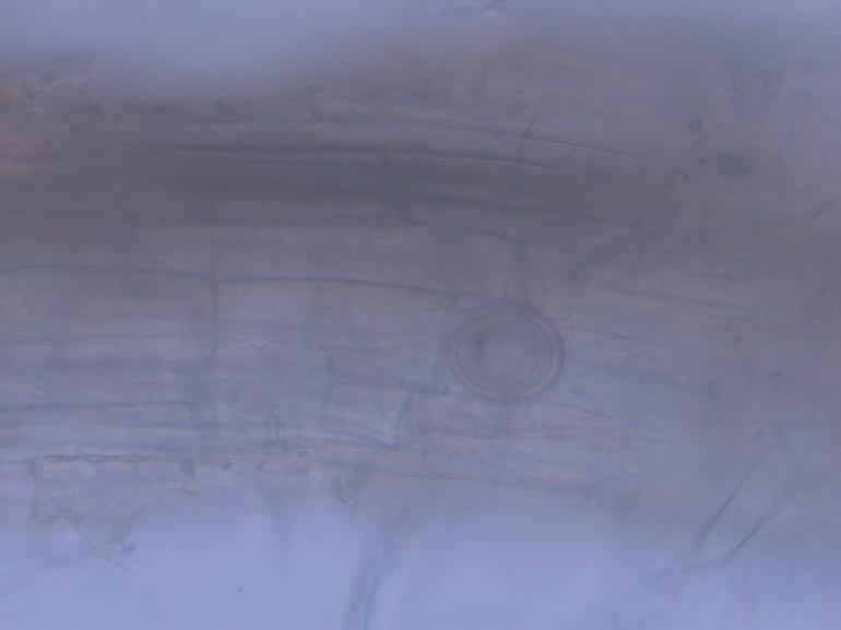 Pythium diseases are not all the same Pythium oospores